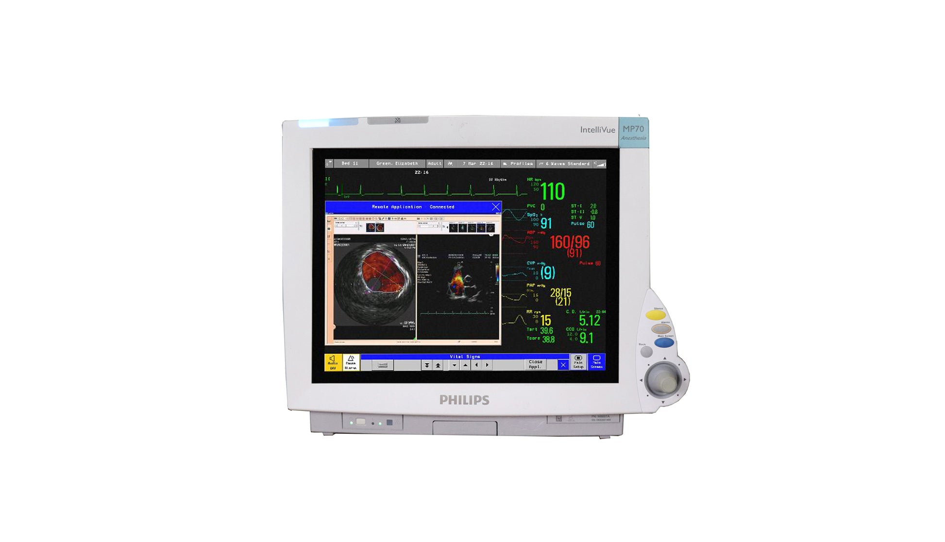 Philips IntelliVue MP2 Portable Monitor - Seattle Technology: Surgical  Division